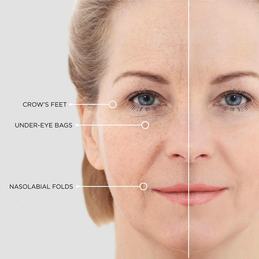 MicroNeedle Eye Patches