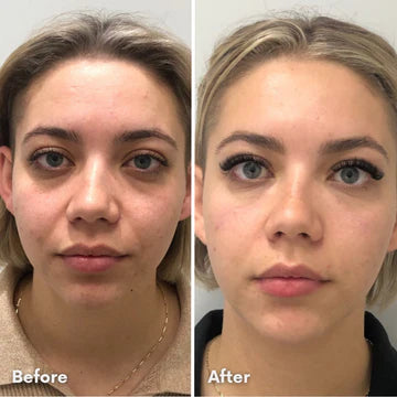 RejuvenEyes Under-Eye Red Light Therapy