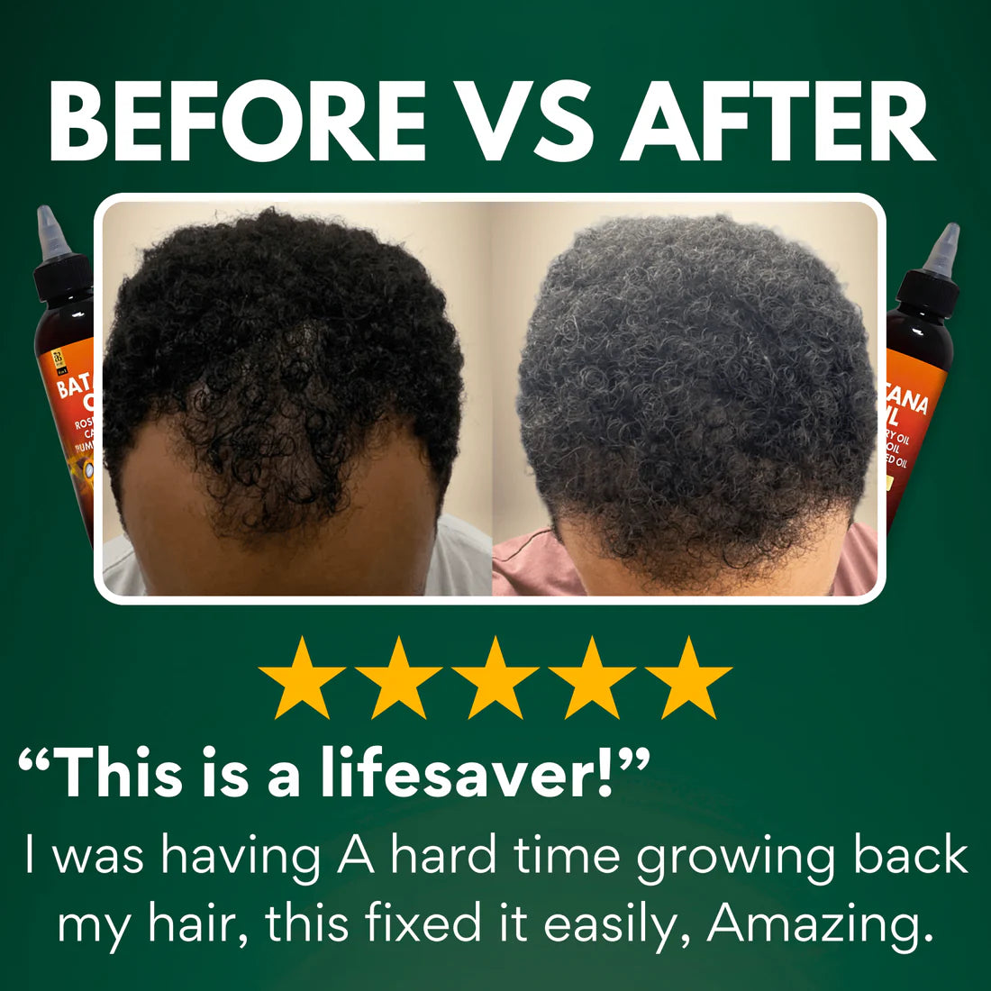 4-in-1 Batana oil hair care blend