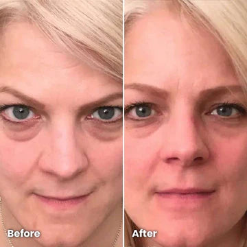 RejuvenEyes Under-Eye Red Light Therapy