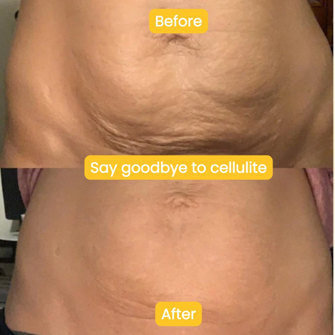 Anti-Cellulite Oil