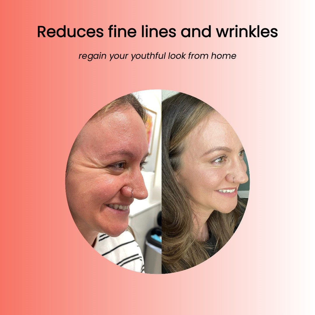 eronon - biolift ampoules