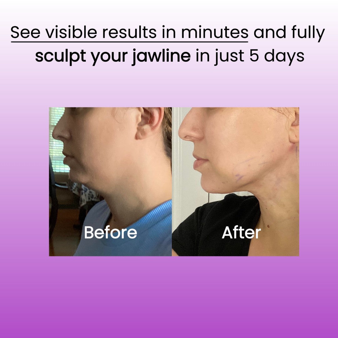 Belye™ Beauty Sculptor